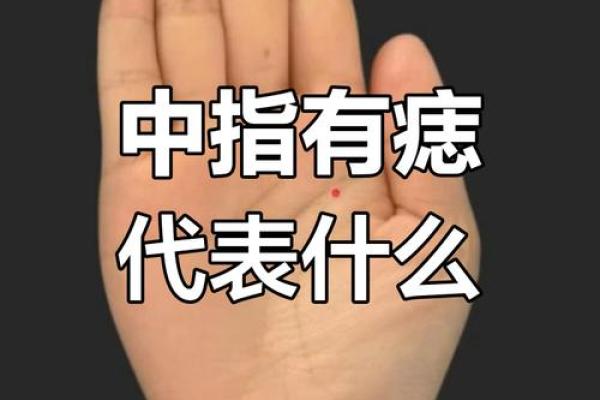 手上黑痣预示什么？揭秘手相痣相的神奇力量！